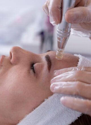 Micro needling