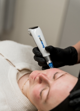 microneedling-nctf-boost-135-ha-list