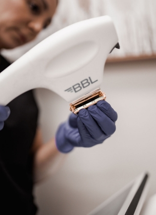 IPL-and-BBL-treatments-list