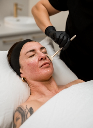 medical-grade-peels-list